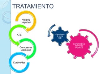 TRATAMIENTO
Higiene
palpebral

ATB

Compresas
Calientes

Corticoides

Prednisona
0.125%
BID
ESTEROIDES
TÓPICOS
DEBILES

 
