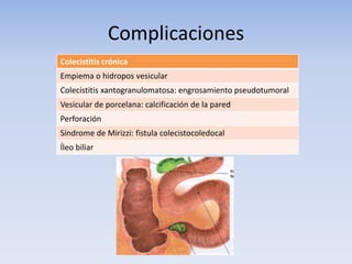 Complicaciones
Colecistitis crónica
Empiema o hidropos vesicular
Colecistitis xantogranulomatosa: engrosamiento pseudotumoral
Vesicular de porcelana: calcificación de la pared
Perforación
Síndrome de Mirizzi: fistula colecistocoledocal
Íleo biliar
 