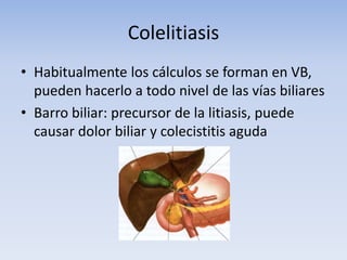Colelitiasis
• Habitualmente los cálculos se forman en VB,
pueden hacerlo a todo nivel de las vías biliares
• Barro biliar: precursor de la litiasis, puede
causar dolor biliar y colecistitis aguda
 