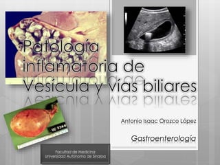 Antonio Isaac Orozco López
Gastroenterología
Facultad de Medicina
Universidad Autónoma de Sinaloa
 