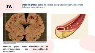 Embolia grasa: gotas de lípidos que pueden llegar a la sangre
debido a traumatismos.
Embolia grasa como complicación de
politraumatismo por precipitación
autolítica
 