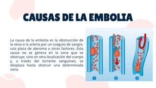 CAUSAS DE LA EMBOLIA
 