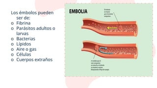 Los émbolos pueden
ser de:
o Fibrina
o Parásitos adultos o
larvas
o Bacterias
o Lípidos
o Aire o gas
o Células
o Cuerpos extraños
 