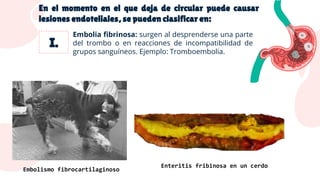 En el momento en el que deja de circular puede causar
lesiones endoteliales, se pueden clasificar en:
Embolia fibrinosa: surgen al desprenderse una parte
del trombo o en reacciones de incompatibilidad de
grupos sanguíneos. Ejemplo: Tromboembolia.
Enteritis fribinosa en un cerdo
Embolismo fibrocartilaginoso
 