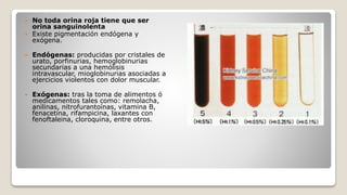  No toda orina roja tiene que ser
orina sanguinolenta
 Existe pigmentación endógena y
exógena.
 Endógenas: producidas por cristales de
urato, porfinurias, hemoglobinurias
secundarias a una hemólisis
intravascular, mioglobinurias asociadas a
ejercicios violentos con dolor muscular.
 Exógenas: tras la toma de alimentos ó
medicamentos tales como: remolacha,
anilinas, nitrofurantoínas, vitamina B,
fenacetina, rifampicina, laxantes con
fenoftaleina, cloroquina, entre otros.
 