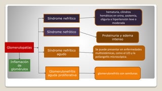 Glomerulopatías
Síndrome nefrítico
Síndrome nefrótico
Síndrome nefrítico
agudo
Glomerulonefrítis
aguda proliferativa
Inflamación
de
glomérulos
hematuria, cilindros
hemáticos en orina, azotemia,
oliguria e hipertensión leve o
moderada
Proteinuria y edema
intenso
Se puede presentar en enfermedades
multisistémicas, como el LES y la
poliangeítis microscópica.
glomerulonefritis con semilunas
 