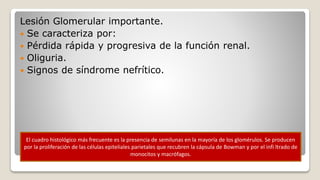 Glomerulonefritis rápidamente progresiva
(con semilunas)
Lesión Glomerular importante.
 Se caracteriza por:
 Pérdida rápida y progresiva de la función renal.
 Oliguria.
 Signos de síndrome nefrítico.
El cuadro histológico más frecuente es la presencia de semilunas en la mayoría de los glomérulos. Se producen
por la proliferación de las células epiteliales parietales que recubren la cápsula de Bowman y por el infi ltrado de
monocitos y macrófagos.
 