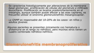 Glomerulonefritis membranoproliferativa
 Se caracteriza histológicamente por alteraciones de la membrana
basal glomerular, proliferación de células del glomérulo e infiltrado
leucocitario. Proliferación se localiza predominantemente en el
mesangio, aunque también puede afectar a las asas capilares, es
frecuente utilizar el sinónimo glomerulonefritis mesangiocapilar.
 La GNMP es responsable del 10-20% de los casos- en niños y
adultos jóvenes.
Algunos pacientes se presentan únicamente con hematuria o
proteinuria en el rango no nefrótico, pero muchos otros tienen un
cuadro combinado nefrótico-nefrítico.
 