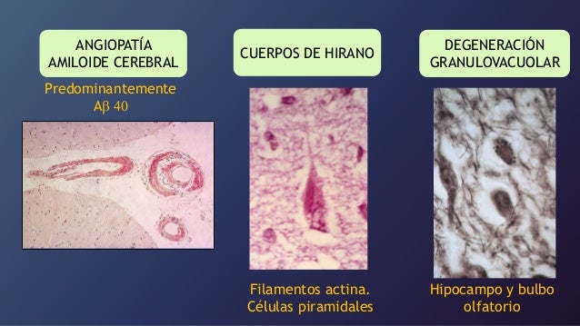 Patología Geriátrica