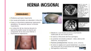 Comprehensive Overview of Hernia Pathology and Abdominal Wall Anatomy | PDF