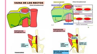Comprehensive Overview of Hernia Pathology and Abdominal Wall Anatomy | PDF