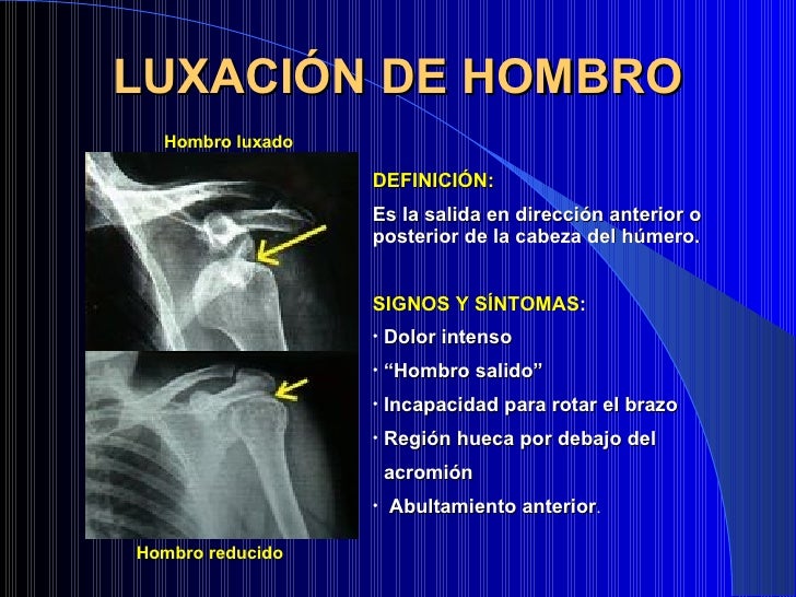 Patología Hombro