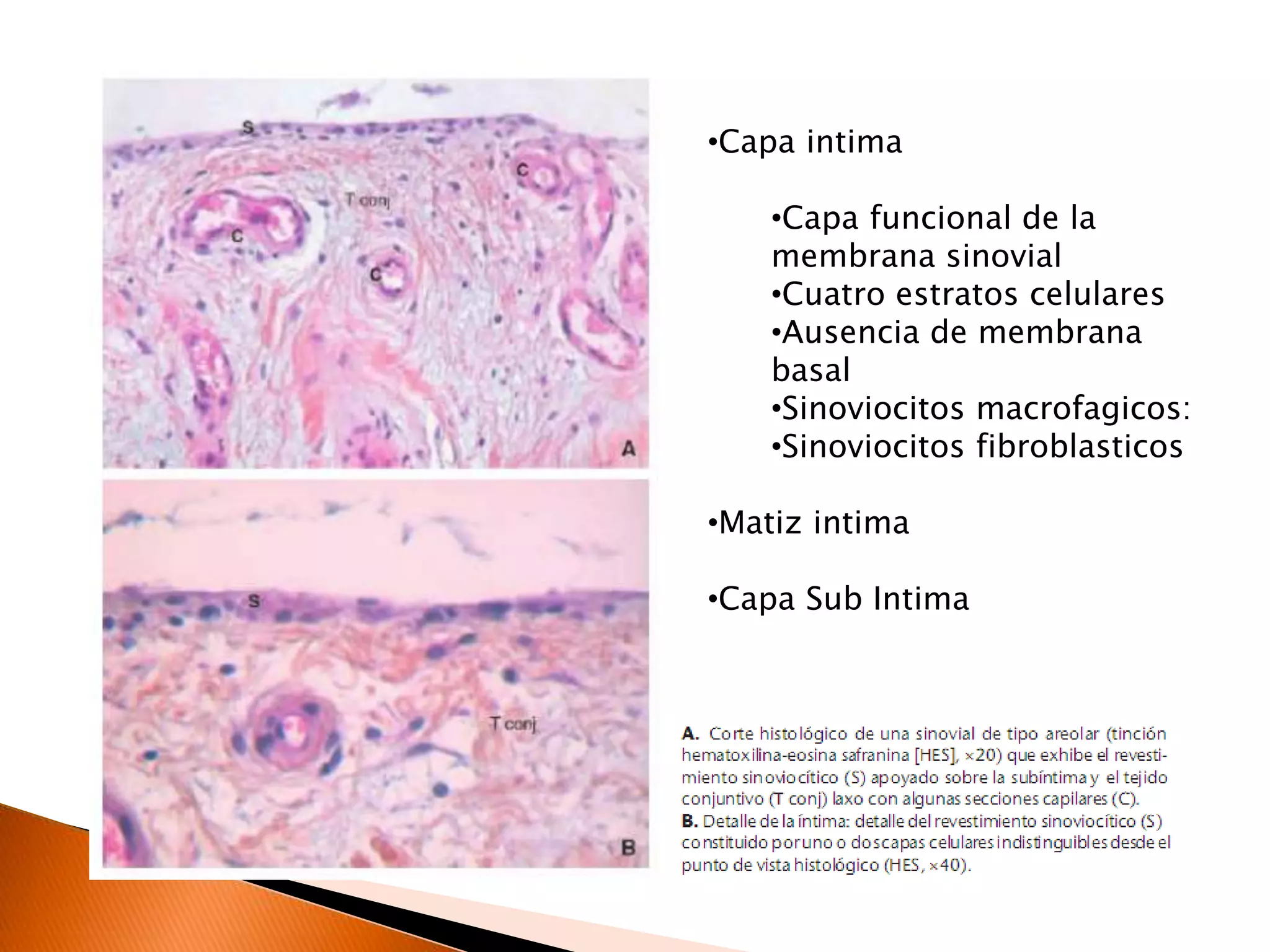 Patología inflamatoria de la membrana sinovial | PPTX