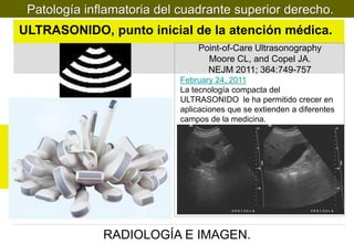 Patología inflamatoria del cuadrante superior derecho.

ULTRASONIDO, punto inicial de la atención médica.
Point-of-Care Ultrasonography
Moore CL, and Copel JA.
NEJM 2011; 364:749-757
February 24, 2011
La tecnología compacta del
ULTRASONIDO le ha permitido crecer en
aplicaciones que se extienden a diferentes
campos de la medicina.

RADIOLOGÍA E IMAGEN.

 