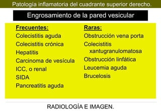 Patología inflamatoria del cuadrante superior derecho.

Engrosamiento de la pared vesicular
Frecuentes:
Colecistitis aguda
Colecistitis crónica
Hepatitis
Carcinoma de vesícula
ICC, o renal
SIDA
Pancreatitis aguda

Raras:
Obstrucción vena porta
Colecistitis
xantugranulomatosa
Obstrucción linfática
Leucemia aguda
Brucelosis

RADIOLOGÍA E IMAGEN.

 