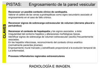 PISTAS:

Engrosamiento de la pared vesicular

CLAVES

Reconocer un posible contexto clínico de cardiopatía.
Valorar el calibre de las venas suprahepáticas como signo secundario asociado al
engrosamiento en el caso de fallo crónico.
Reconocer signos de sobrecarga extravascular de volumen (derrame pleural o
pericárdico)
Reconocer el contexto de hepatopatía y los signos asociados a ésta:
Irregularidad del contorno hepático y alteraciones morfológicas típicas.
Identificar signos de sobrecarga de volumen extravascular (ascitis) frecuentemente
asociados.
En las hepatitis infecciosas, reconocimiento del contexto clínico analítico
(normalmente pacientes jóvenes).
Engrosamiento mural marcado y estratificado proporcional a la evolución temporal de
La enfermedad.
Procesos inflamatorios regionales extravesiculares

RADIOLOGÍA E IMAGEN.

 