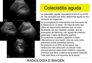 Colecistitis aguda
La colecistitis aguda representa entre el 3 y el 9%
de las consultas por dolor abdominal agudo en los
servicios de Urgencias.
Es la complicación inflamatoria más frecuente de
la litiasis de la vía biliar. Se trata de dolor tipo
cólico en hipocondrio derecho que no cede
fácilmente con las medidas usuales, que se
acompaña de febricula, con signos de irritación
peritoneal y signo de Murphy positivo.
En ocasiones se palpa u plastrón o masa
inflamatoria en esa región. Uno de cada cinco
pacientes puede presentar ictericia.
Se produce en el 95% de los casos, por
obstrucción del cistico por un cálculo. Este
proceso genera obstrucción linfática y vascular
(venosa) que lleva a edema de la pared vesicular.
Todo esto lleva a la isquemia de la pared.

RADIOLOGÍA E IMAGEN.

 