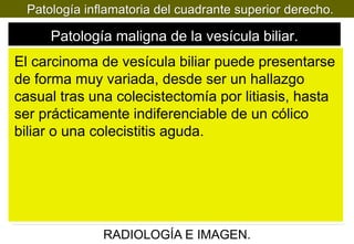 Patología inflamatoria del cuadrante superior derecho.

Patología maligna de la vesícula biliar.
El carcinoma de vesícula biliar puede presentarse
de forma muy variada, desde ser un hallazgo
casual tras una colecistectomía por litiasis, hasta
ser prácticamente indiferenciable de un cólico
biliar o una colecistitis aguda.

RADIOLOGÍA E IMAGEN.

 