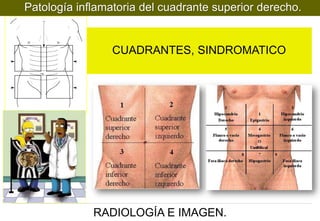 Patología inflamatoria del cuadrante superior derecho.

CUADRANTES, SINDROMATICO

RADIOLOGÍA E IMAGEN.

 
