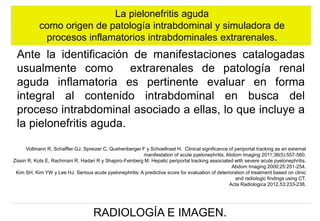 La pielonefritis aguda
como origen de patología intrabdominal y simuladora de
procesos inflamatorios intrabdominales extrarenales.

Ante la identificación de manifestaciones catalogadas
usualmente como extrarenales de patología renal
aguda inflamatoria es pertinente evaluar en forma
integral al contenido intrabdominal en busca del
proceso intrabdominal asociado a ellas, lo que incluye a
la pielonefritis aguda.
Vollmann R, Schaffler GJ, Spreizer C, Quehenberger F y Schoellnast H. Clinical significance of periportal tracking as an external
manifestation of acute pyelonephritis. Abdom Imaging 2011;36(5):557-560.
Zissin R, Kots E, Rachmani R, Hadari R y Shapiro-Feinberg M. Hepatic periportal tracking associated with severe acute pyelonephritis.
Abdom Imaging 2000;25:251-254.
Kim SH, Kim YW y Lee HJ. Serious acute pyelonephritis: A predictive score for evaluation of deterioration of treatment based on clinic
and radiologic findings using CT.
Acta Radiologica 2012,53:233-238.

RADIOLOGÍA E IMAGEN.

 