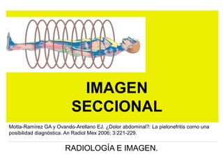 IMAGEN
SECCIONAL
Motta-Ramírez GA y Ovando-Arellano EJ. ¿Dolor abdominal?: La pielonefritis como una
posibilidad diagnóstica. An Radiol Mex 2006; 3:221-229.

RADIOLOGÍA E IMAGEN.

 
