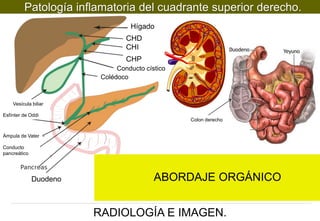 Patología inflamatoria del cuadrante superior derecho.
Hígado
CHD
CHI
CHP
Conducto cístico
Colédoco

Vesícula biliar
Esfínter de Oddi
Colon derecho
Ámpula de Vater
Conducto
pancreático

Duodeno

ABORDAJE ORGÁNICO
RADIOLOGÍA E IMAGEN.

 