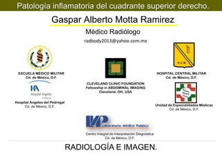 Patología inflamatoria del cuadrante superior derecho.

Gaspar Alberto Motta Ramirez
Médico Radiólogo
radbody2013@yahoo.com.mx

1er autor:
H. C. M.

ESCUELA MÉDICO MILITAR
Cd. de México, D.F.

HOSPITAL CENTRAL MILITAR
Cd. de México, D.F.
CLEVELAND CLINIC FOUNDATION
Fellowship in ABDOMINAL IMAGING
Cleveland, OH, USA

Hospital Ángeles del Pedregal
Cd. de México, D.F.

Unidad de Especialidades Médicas
Cd. de México, D.F.

Centro Integral de Interpretación Diagnóstica
Cd. de México, D.F.

RADIOLOGÍA E IMAGEN.

 