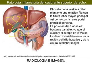 Patología inflamatoria del cuadrante superior derecho.
El cuello de la vesícula biliar
mantiene una relación fija con
la fisura lobar mayor, principal
así como con la rama portal
principal derecha.
La posición del fundus es
bastante variable, ya que el
cuello y el cuerpo de la VB se
localizan invariablemente en la
región del hilio hepático y de la
cisura interlobar mayor.

http://www.slideshare.net/betomotta/y-donde-esta-la-vesicula-biliar-2677957

RADIOLOGÍA E IMAGEN.

 