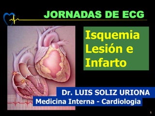 1
JORNADAS DE ECG
Dr. LUIS SOLIZ URIONA
Medicina Interna - Cardiologia
Isquemia
Lesión e
Infarto
 