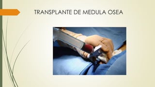 TRANSPLANTE DE MEDULA OSEA
 