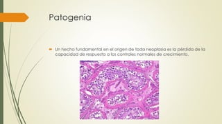 Patogenia
 Un hecho fundamental en el origen de toda neoplasia es la pérdida de la
capacidad de respuesta a los controles normales de crecimiento.
 