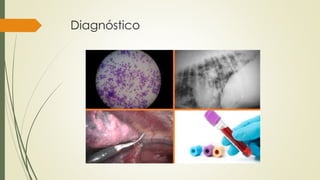Diagnóstico
 