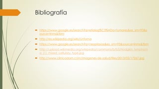 Bibliografía
 https://www.google.es/search?q=etiolog%C3%ADa+tumores&es_sm=93&s
ource=lnms&tbm
 http://es.wikipedia.org/wiki/Linfoma
 https://www.google.es/search?q=neoplasias&es_sm=93&source=lnms&tbm
 http://upload.wikimedia.org/wikipedia/commons/b/b3/Hodgkin_lymphom
a_(1)_mixed_cellulary_type.jpg
 http://www.clinicadam.com/imagenes-de-salud/files/2013/02/17267.jpg
 