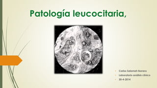 Patología leucocitaria,
• Carlos Salameh Borrero
• Laboratorio análisis clínico
• 30-4-2014
 