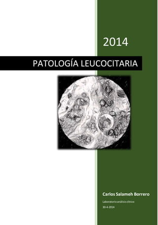 2014
Carlos Salameh Borrero
Laboratorioanálisisclínico
30-4-2014
PATOLOGÍA LEUCOCITARIA
 