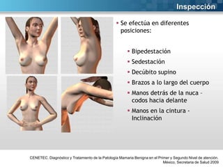 Inspección
 Se efectúa en diferentes
posiciones:
 Bipedestación
 Sedestación
 Decúbito supino
 Brazos a lo largo del cuerpo

 Manos detrás de la nuca –
codos hacia delante
 Manos en la cintura Inclinación

CENETEC. Diagnóstico y Tratamiento de la Patología Mamaria Benigna en el Primer y Segundo Nivel de atención.
México, Secretaria de Salud 2009

 