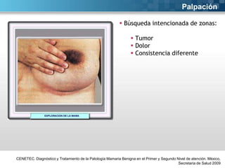 Palpación
 Búsqueda intencionada de zonas:
 Tumor
 Dolor
 Consistencia diferente

CENETEC. Diagnóstico y Tratamiento de la Patología Mamaria Benigna en el Primer y Segundo Nivel de atención. México,
Secretaria de Salud 2009

 