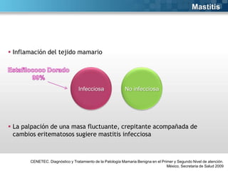 Mastitis

 Inflamación del tejido mamario

Infecciosa

No infecciosa

 La palpación de una masa fluctuante, crepitante acompañada de
cambios eritematosos sugiere mastitis infecciosa

CENETEC. Diagnóstico y Tratamiento de la Patología Mamaria Benigna en el Primer y Segundo Nivel de atención.
México, Secretaria de Salud 2009

 