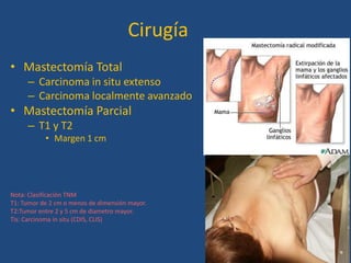 Cirugía
• Mastectomía Total
     – Carcinoma in situ extenso
     – Carcinoma localmente avanzado
• Mastectomía Parcial
     – T1 y T2
           • Margen 1 cm




Nota: Clasificación TNM
T1: Tumor de 2 cm o menos de dimensión mayor.
T2:Tumor entre 2 y 5 cm de diametro mayor.
Tis: Carcinoma in situ (CDIS, CLIS)
 