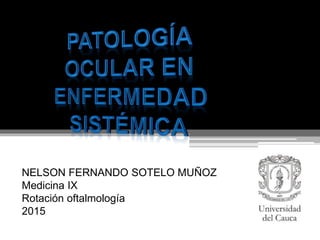 NELSON FERNANDO SOTELO MUÑOZ
Medicina IX
Rotación oftalmología
2015
 