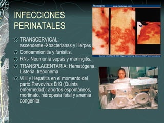 Patología perinatal | PPT