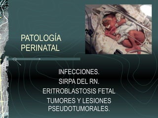 PATOLOGÍA PERINATAL INFECCIONES. SIRPA DEL RN. ERITROBLASTOSIS FETAL TUMORES Y LESIONES PSEUDOTUMORALES. 