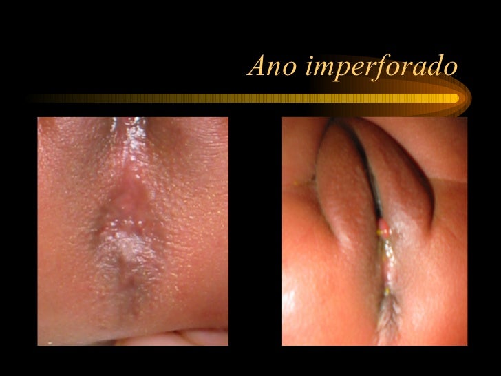 Las máscaras para la persona del aloe de los tiempos