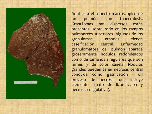 Patologías Pulmonar