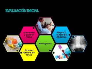 Examen 
General de 
Orina 
Hemograma 
Anamnesis 
y Examen 
Físico 
Rayos X 
Simple de 
Abdomen 
 