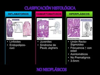 INFLAMATORIOS 
• Linfoides 
• Endopolipos-cuci 
HAMARTOMATOSOS 
• Juveniles 
• Síndrome de 
Peutz Jeghers 
HIPERPLÁSICOS 
• Unión Recto- 
Sigmoidea 
• Frecuencia ↑ con 
edad 
• Asintomáticos 
• No Premalignos 
• 3-5mm 
 