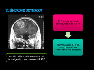 El Ca colorrectal  
consecuencia de la PAF 
Aparecerá de 10 a 15 
años después del 
comienzo de la poliposis 
Asocia pólipos adenomatosos del 
tubo digestivo con tumores del SNC 
 