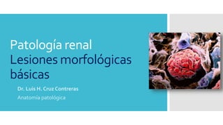 Patología renal
Lesiones morfológicas
básicas
Dr. Luis H. Cruz Contreras
Anatomía patológica
 