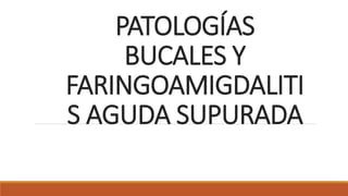 PATOLOGÍAS
BUCALES Y
FARINGOAMIGDALITI
S AGUDA SUPURADA
 