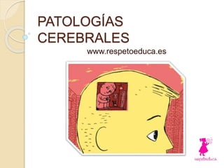 PATOLOGÍAS
CEREBRALES
www.respetoeduca.es
 